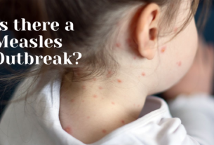 Is there a Measles Outbreak?